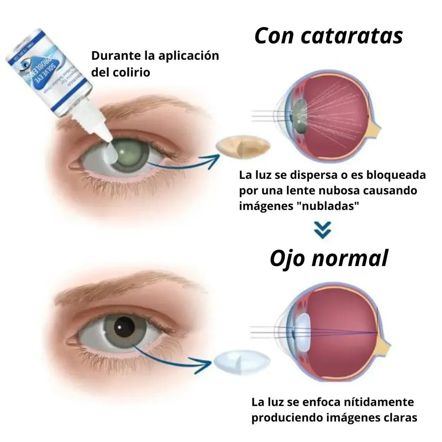 ¡PAGUE 1 LLEVE 2! GOTAS OFTÁLMICAS MILAGROSAS PARA PROBLEMAS DE OJOS