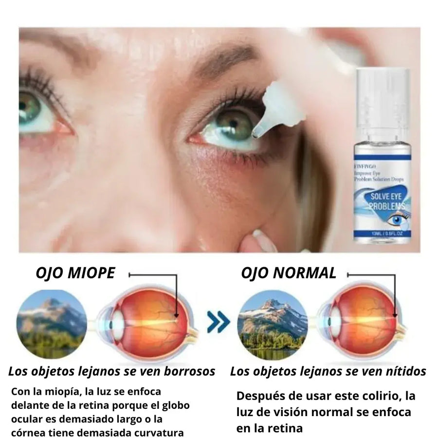 ¡PAGUE 1 LLEVE 2! GOTAS OFTÁLMICAS MILAGROSAS PARA PROBLEMAS DE OJOS