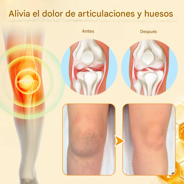 🔥🐝(PROMO 2x1)Crema Biancat™ para aliviar el dolor y la curación de las articulaciones con veneno de abeja🐝🔥